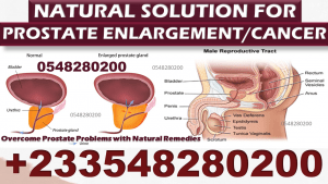 Natural Prostate Enlargement Pack